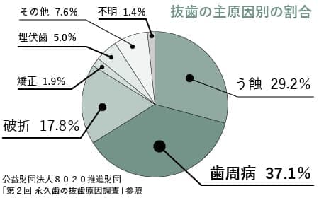 歯周病は歯を失う原因の約50％を占める病気です