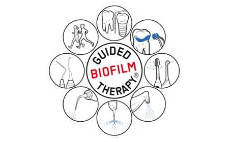 「世界基準」のスウェーデン式予防歯科で生涯の健康を