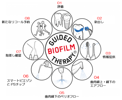 三好歯科 自由が丘のスウェーデン式予防歯科の8つの工程の円形の模式図