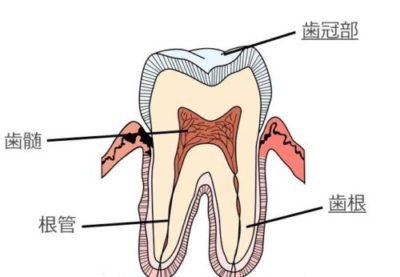 三好歯科 自由が丘歯の断面図 歯冠部 歯根 歯髄 根管