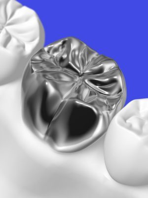 三好歯科自由が丘歯の被せ物保険の金属