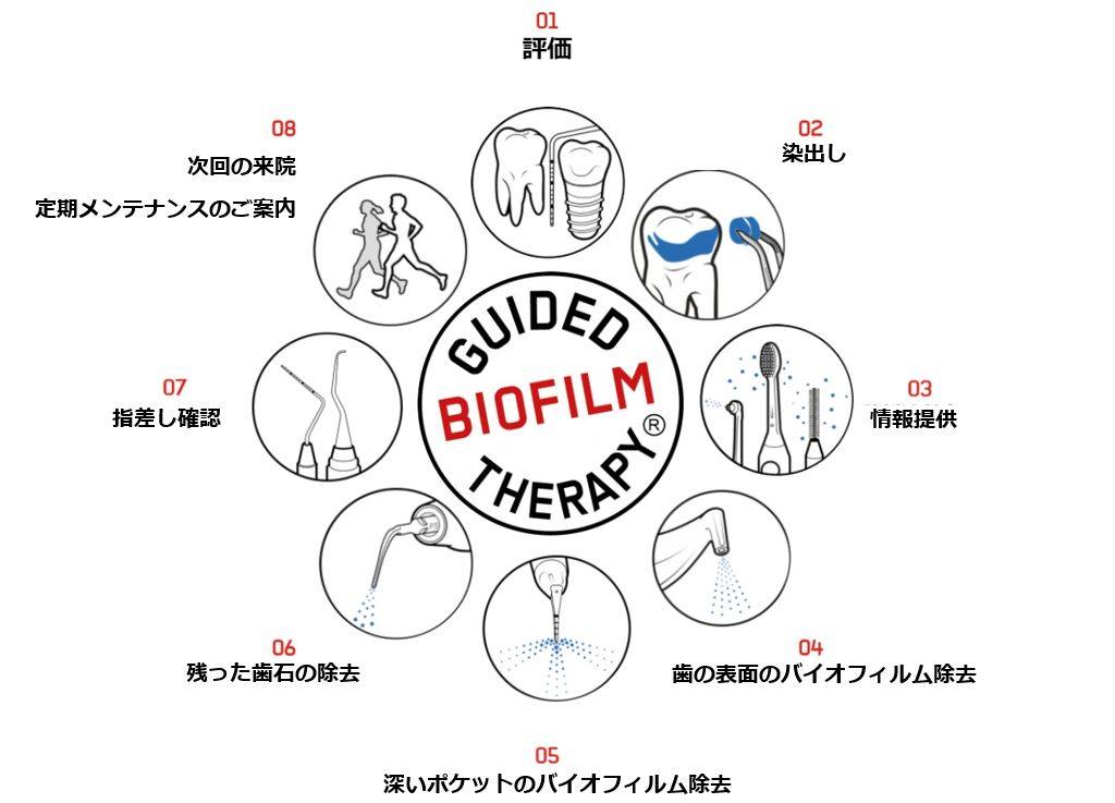 GBTコンセプトの図_文字あり